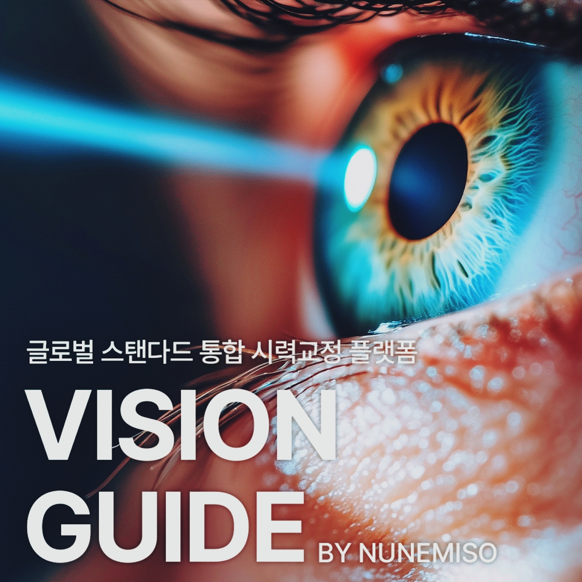 스마일라식 메인