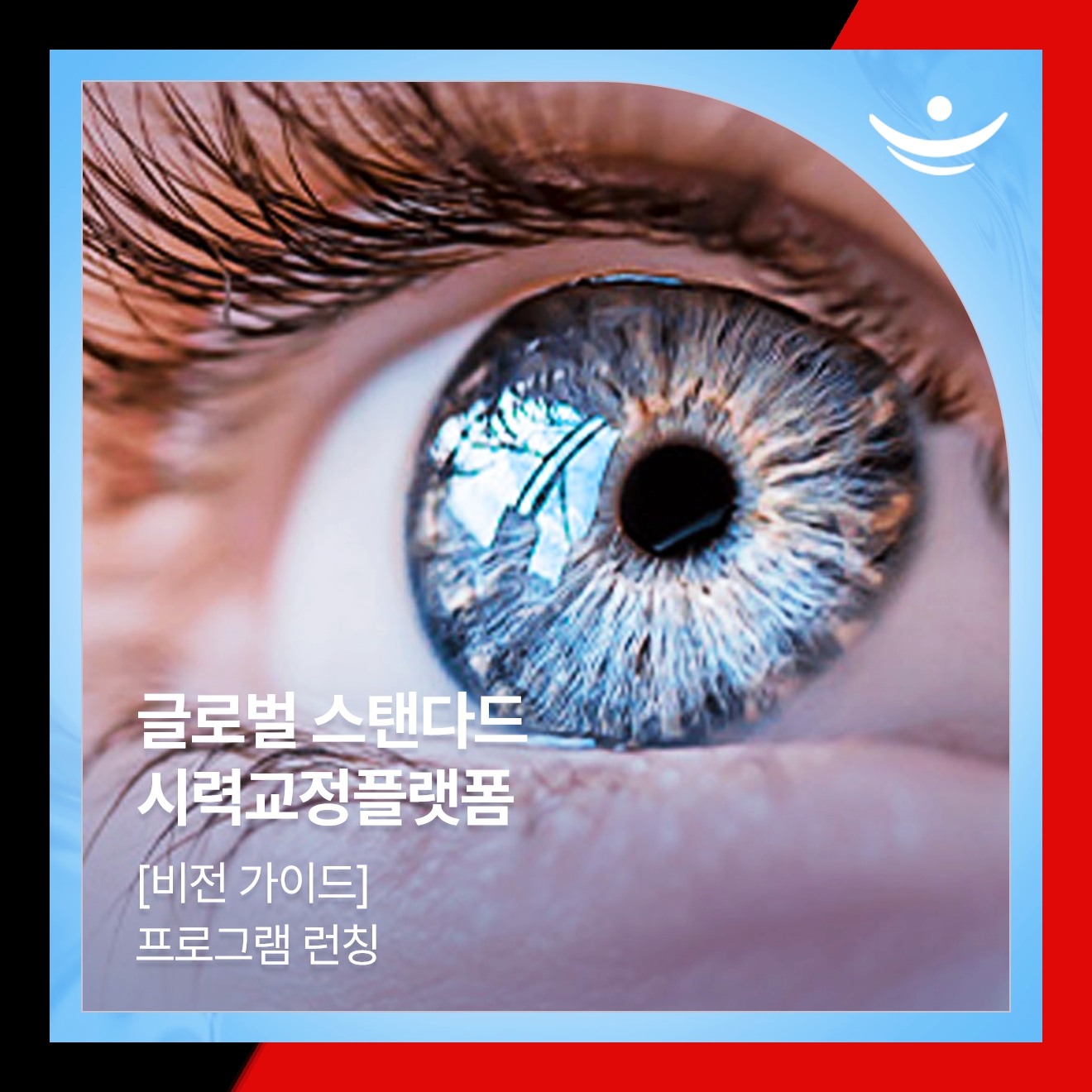 스마일라식비용 어느 정도 생각하면 될까요? 스마일라식비용 어느 정도 생각하면 될까요